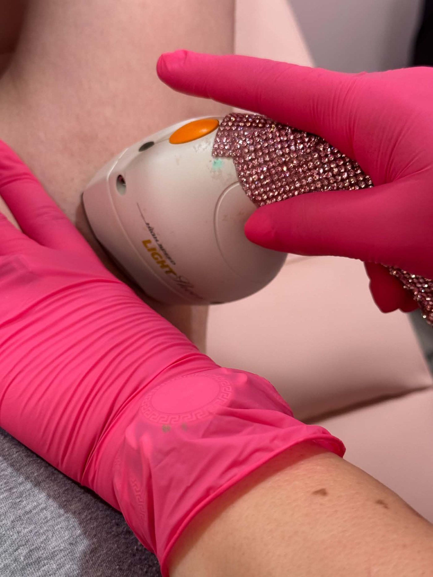 Close-up of laser hair removal treatment with pink gloves