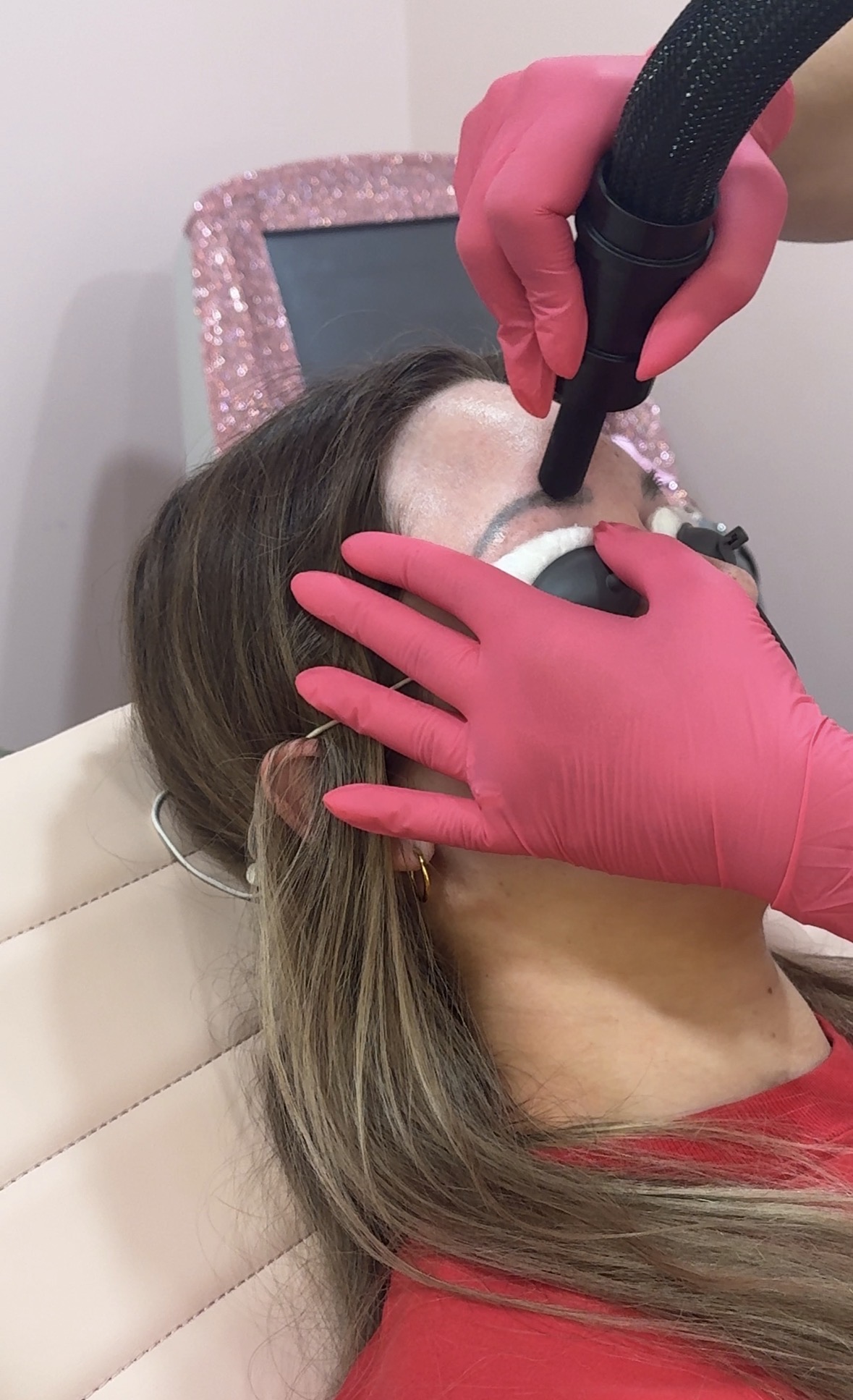Permanent Makeup Removal in Lafayette, LA